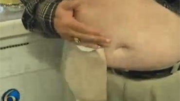 Tom Sawyer of Romulus, Mich., a 61-year-old bladder cancer survivor, says an aggressive airport security pat-down dislodged and spilled his urostomy bag, and he had to board a plane with his clothing soaked with urine.  