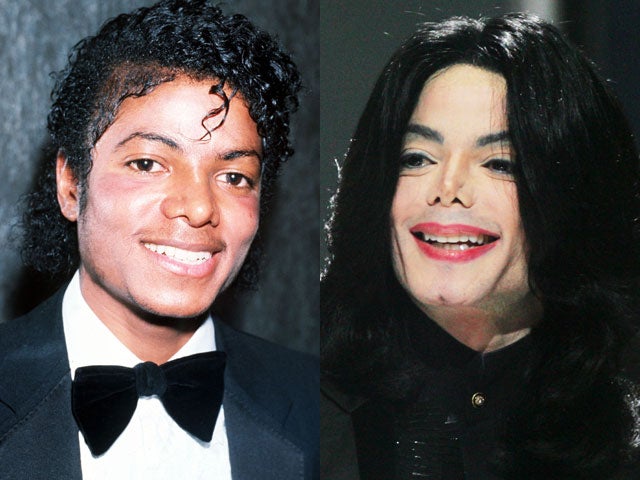 A before-and-after image showcasing Michael Jackson's plastic surgery transformations