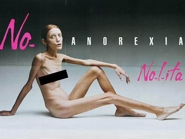 Italian billboard against anorexia featured 59-pound French model Isabelle Caro. 