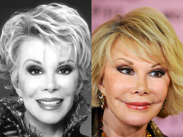 Celebrity Plastic Surgery Disasters?