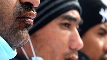 Greece Illegal Immigration 