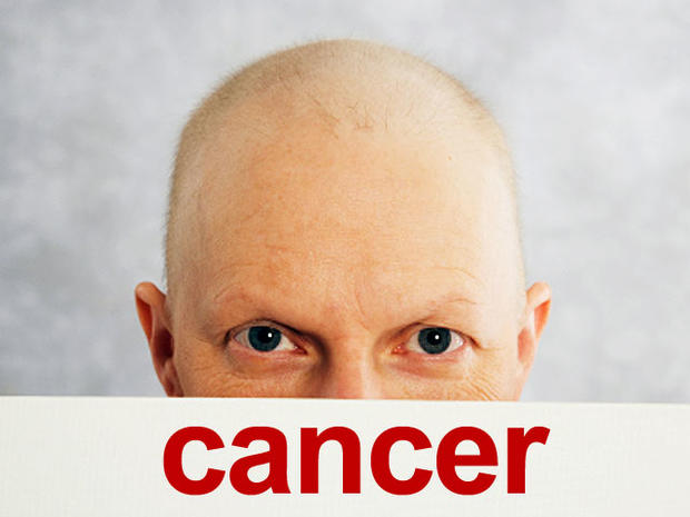 cancer-bald-shaved-head-000_1.jpg 
