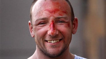 Adam Potter, 1,000-Foot Fall Survivor 