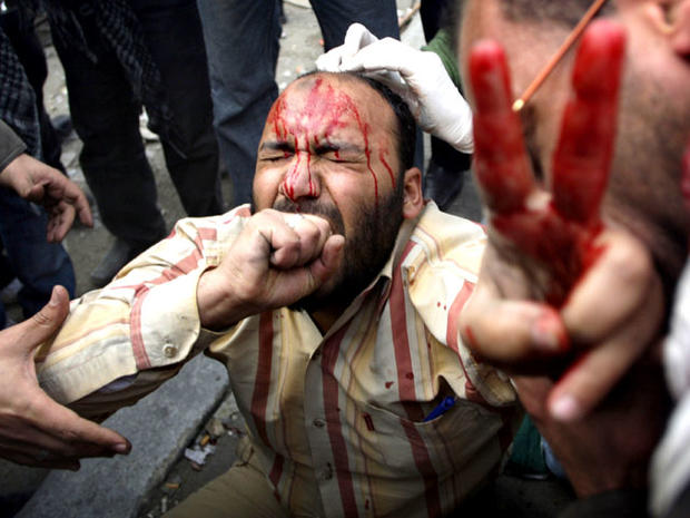 Wounded anti-government protester in Cairo 
