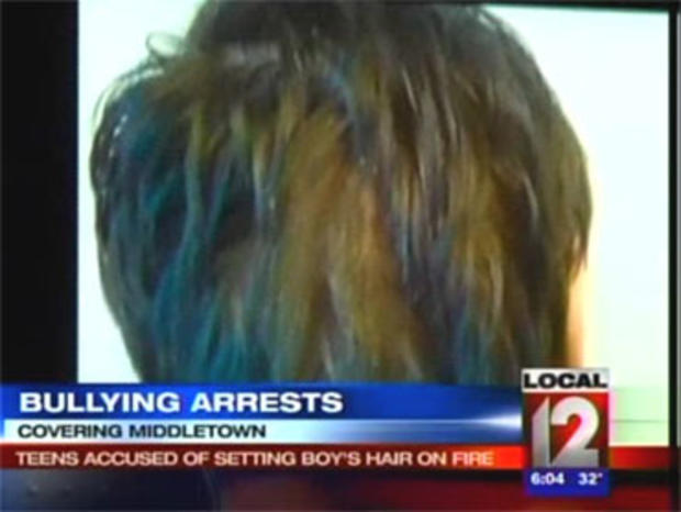Ohio Teen's Hair Set on Fire on School Bus 