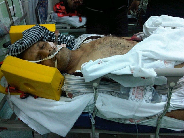 Alleged victim of Pearl Square crackdown Ali Khadeer 