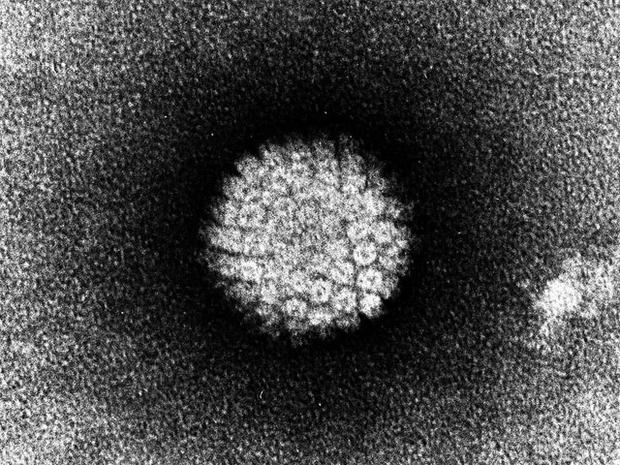 hpv, human papillomavirus, 4x3 