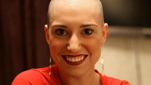 Bald and beautiful: Cancer patients' inspiring stories 
