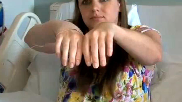 Emily Fennell shows off hand transplant 