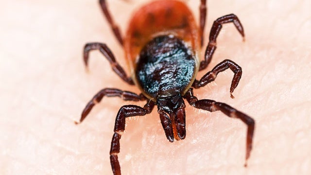 lyme disease, tick, bite, stock, 4x3 