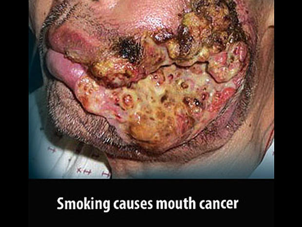 mauritius2-tobaccowarninglabel.jpg 