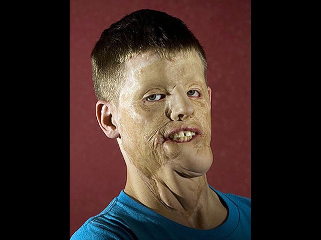 beforetransplant.jpg 