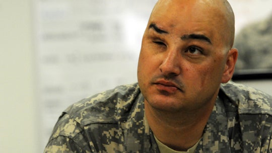 Healing emotional war wounds