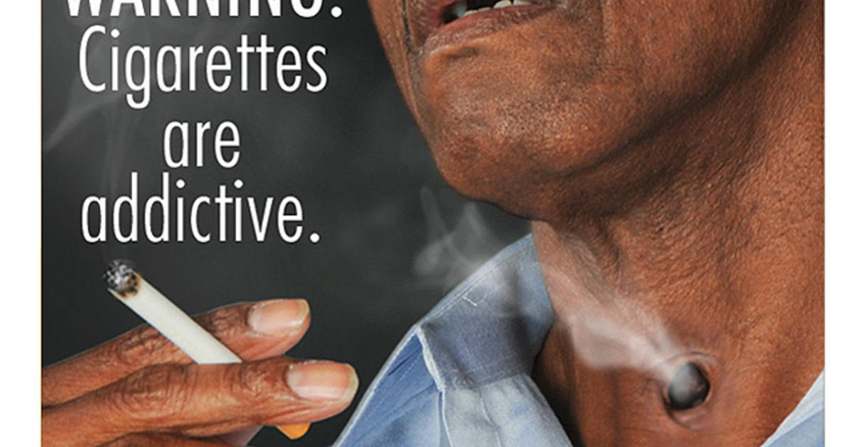 Fda Releases New Graphic Cigarette Warning Labels Cbs Boston 