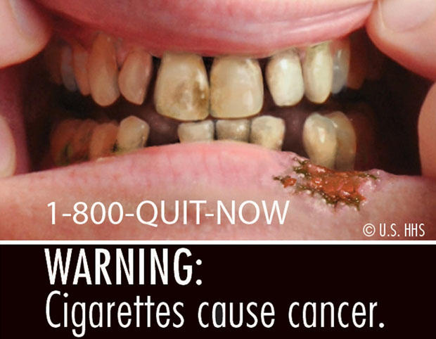 FDA-Issued Cigarette Warning Label 