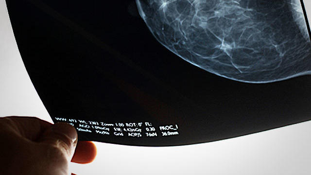 mammoogram-examined.jpg 