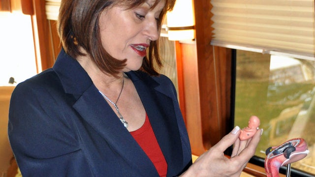 Leslee Unruh of the Alpha Center crisis pregnancy center holds a model fetus 