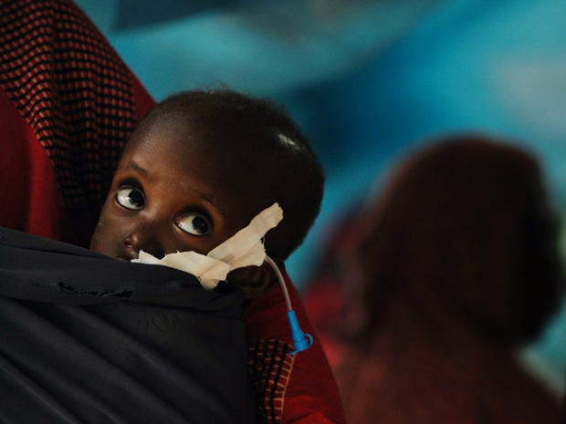 Shiniyo looks while bundled in her mothers arms while they stay at a clinic run by Doctors Without Borders  