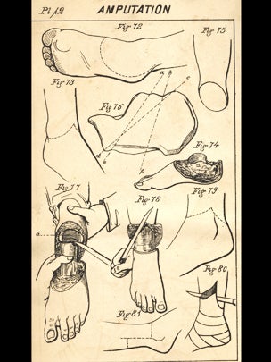Civil War medicine: 37 pieces of history