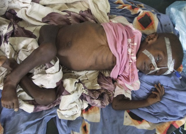 somalia_famine_5_AP110726120717.JPG 