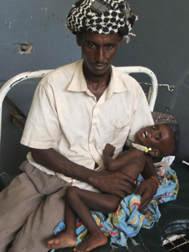 somalia_famine_7_AP110726118208.JPG 