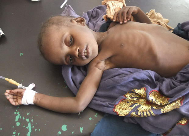 somalia_famine_9_AP110726117291.JPG 