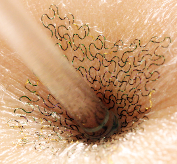 Smart Skin: Can "tattoos" tell when you're sick? 