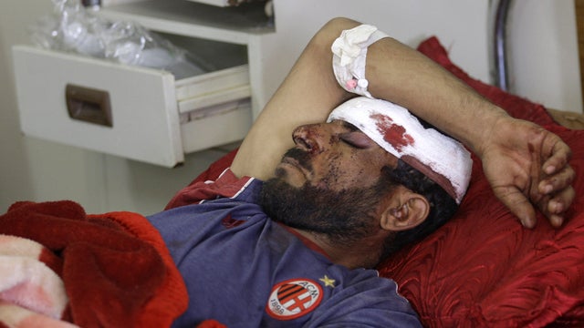 Samir Yousif, 31, is treated after a car bomb in Kut 
