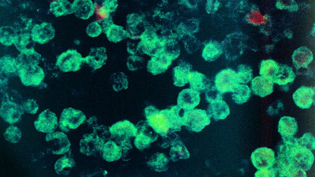 naegleria 