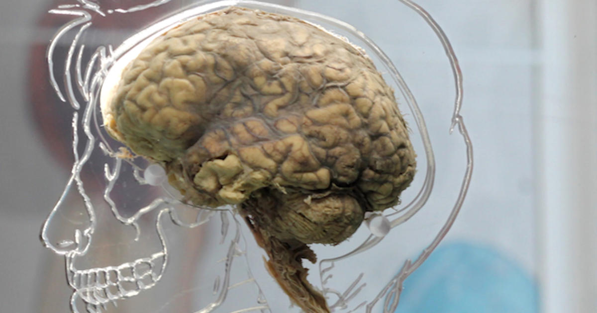 The Inept Story Behind 100 Missing Brains at the University of