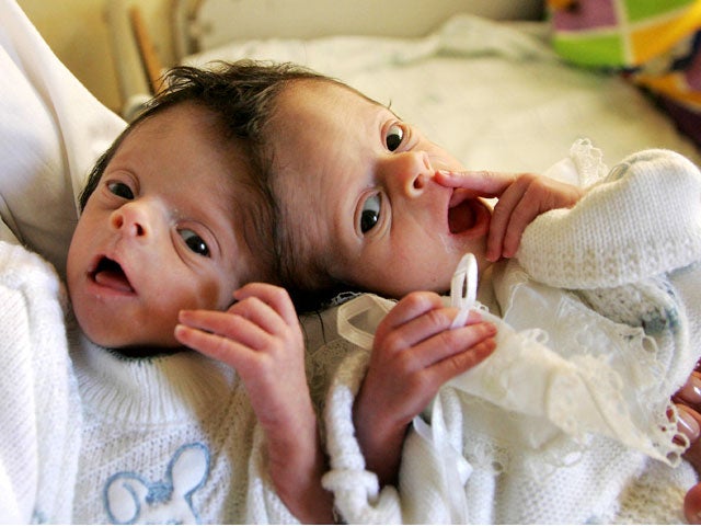 Here's What Conjoined Twins Abby and Brittany Are Up To