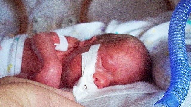 premature baby, preemie, hospital, birth, stock, 4x3 
