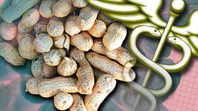 peanut-allergies-1011.jpg 