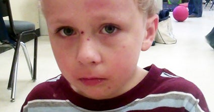 Hospital releases autistic Va. boy who spent 5 days in woods - CBS News