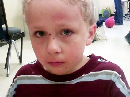 Hospital releases Va boy who spent 5 days in woods 