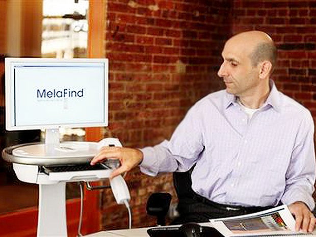 melafind, melanoma, skin cancer 