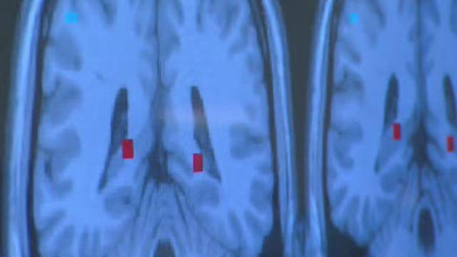brain-scans-1122.jpg 