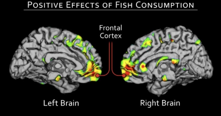 Eating fish tied to dramatic drop in Alzheimer's risk CBS News