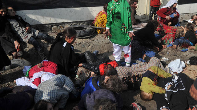 Afghan Shiite Muslim's cry near dead and injured after an explosion 