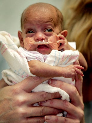 Guinness world records smallest baby on sale