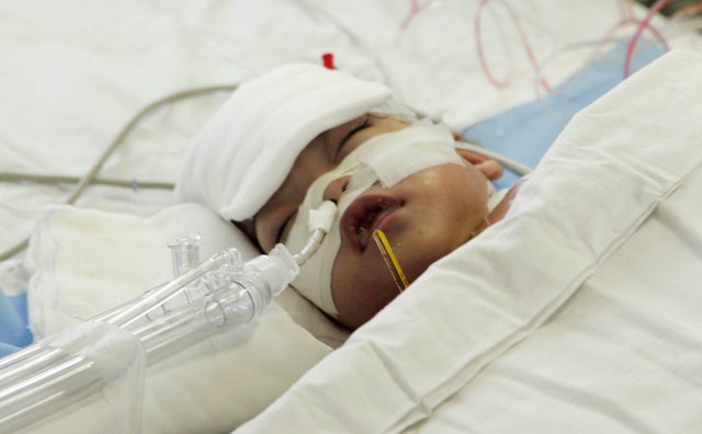 conjoined twins, chile, maria paz paredes navarrete 