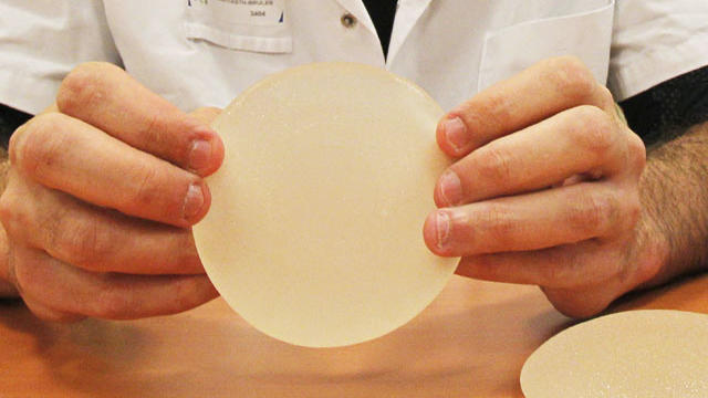 breast implants, pip, france, poly implant prothese 