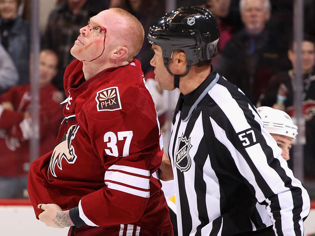 Raffi Torres skates off the ice after a fight with Adam McQuaid 
