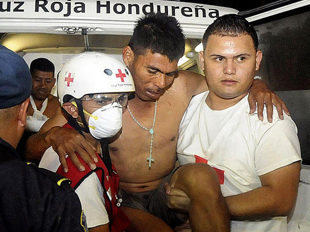 An injured inmate is carried as he arrives at the hospital after a fire broke out at the prison in Comayagua, Honduras, a town 90 miles north of the Central American country's capital, Tegucigalpa, early Wednesday, Feb. 15, 2012. 