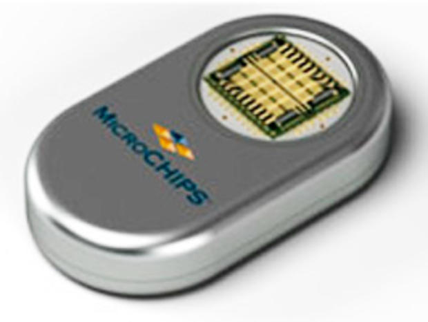 microchip implant 