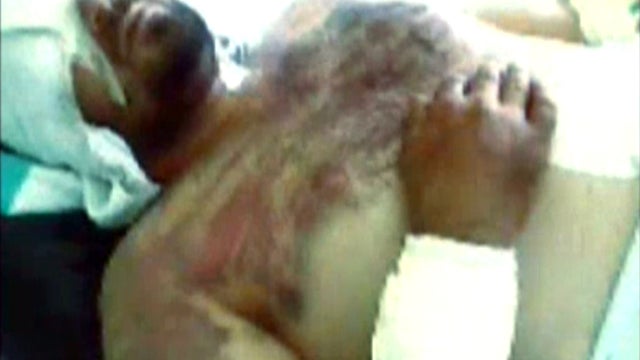 Rebels tortured in Syrian hospital? 