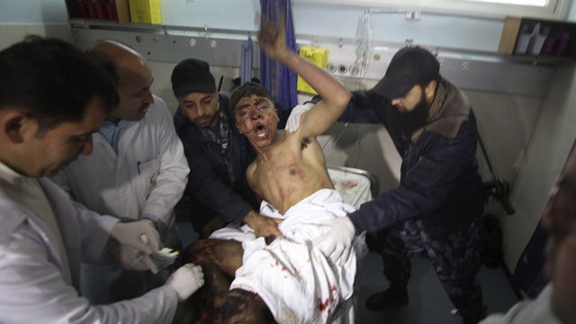 Gaza, patient, bomb, Palestine, palestinians 