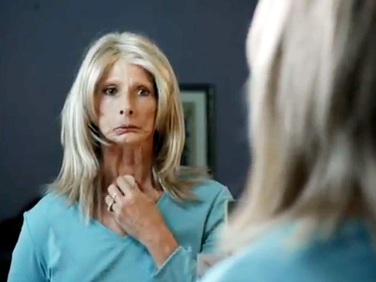 Woman In Graphic Anti Smoking Ad Dies From Cancer Cbs News