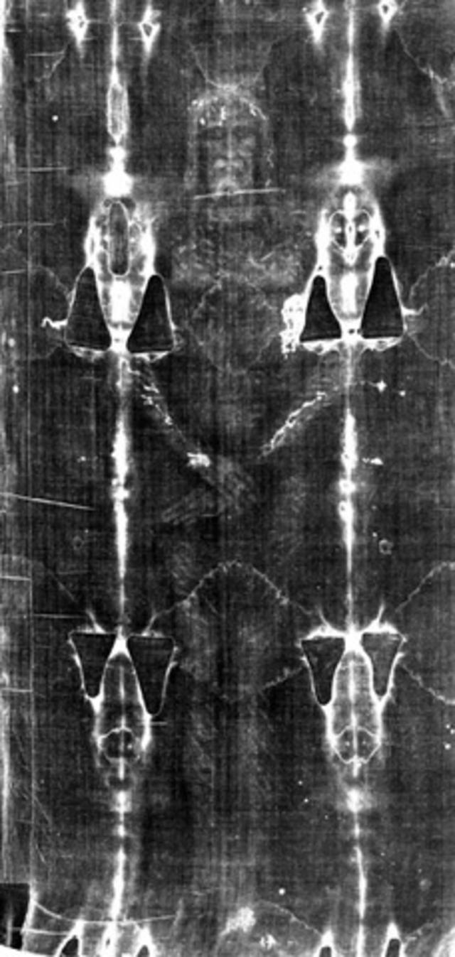 The Shroud of Turin, age regression, and a 12-year-old Jesus