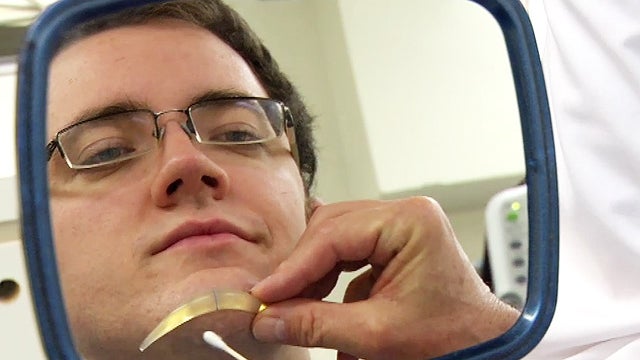 chinplant, chinplants, chin implants, 